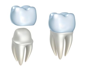 image of crowns on teeth