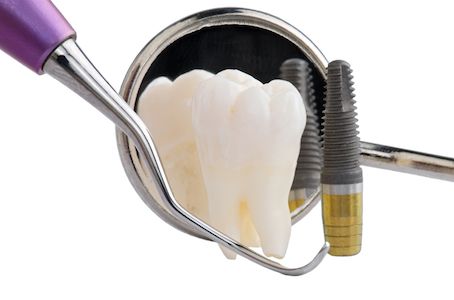 restorative dentistry tools